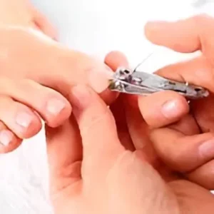 corte tecnico unhas maringa Tratamentos Podológicos em Maringá